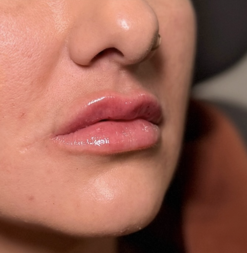 Favorite Day Lips testimonial photo